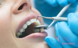 фото лечение зубов