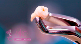 фото удаление зуба стоматология